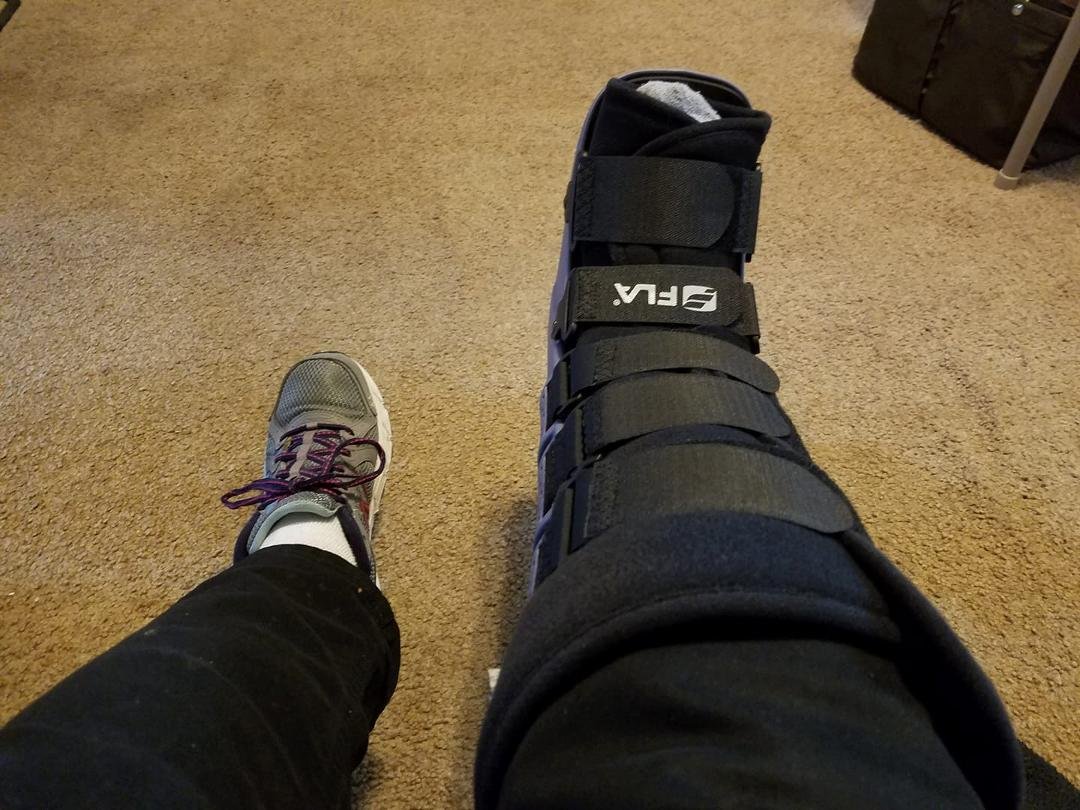 This was my Birthday present fractured my fibula about 3 weeks ago tomorrow and found out Friday afternoon. It's my Swedish heritage that gives me the stubbornness to keep going. Will be getting a cast on this afternoon.