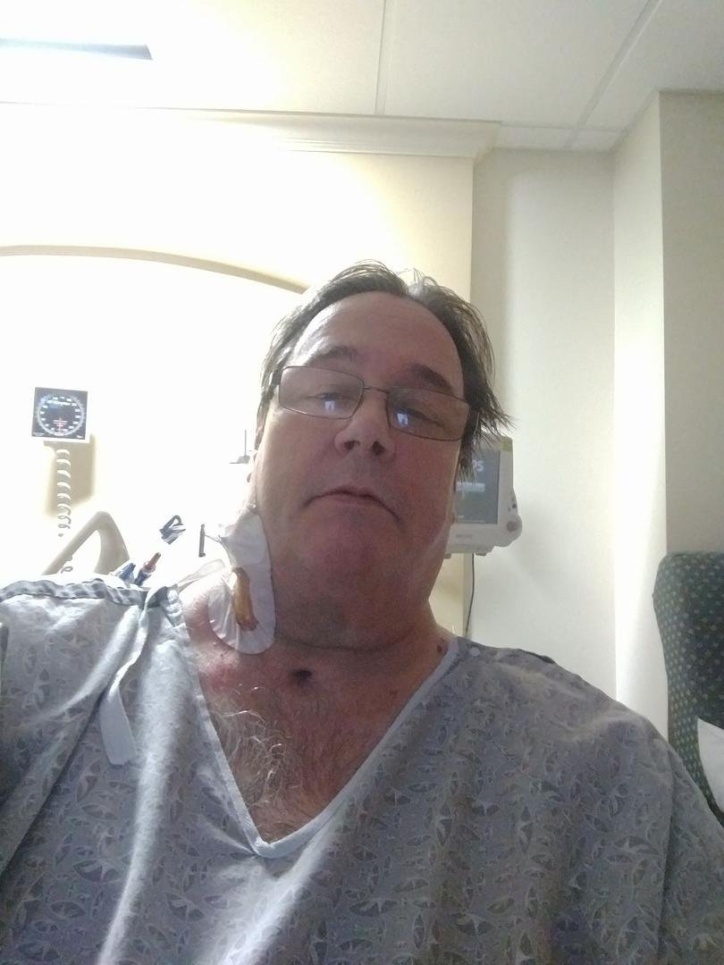 Not exactly a flattering photo, but I'm back to sitting up, and doing it with Tylenol only!!!