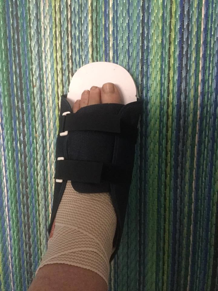 Now, this has put a stop to my giddy up. Spiral fracture of the fifth metatarsal, the long bone on the outside of my foot. Walking the dogs is a challenge. Feeding the pups downstairs is a slow process but not too bad.