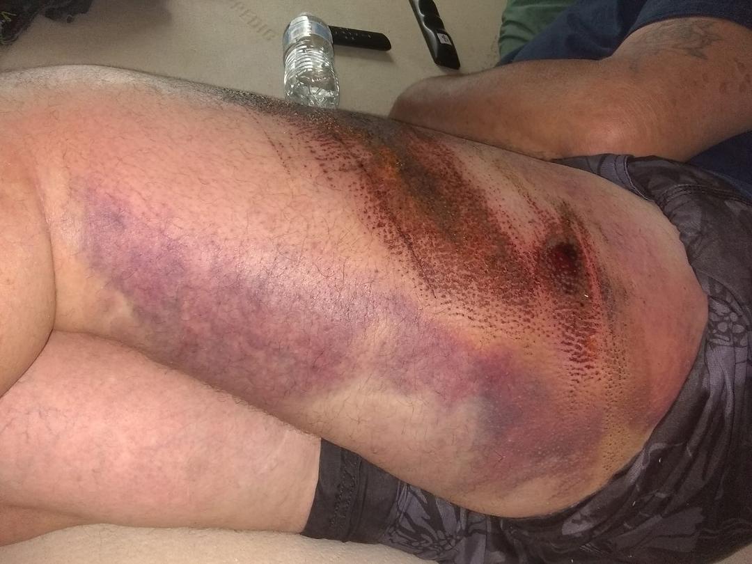 Back of the leg