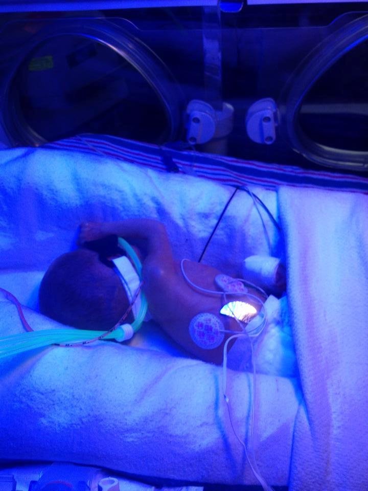 Sophia Ann perry. Born at 26 weeks.1 lb 11oz on April 3,2015