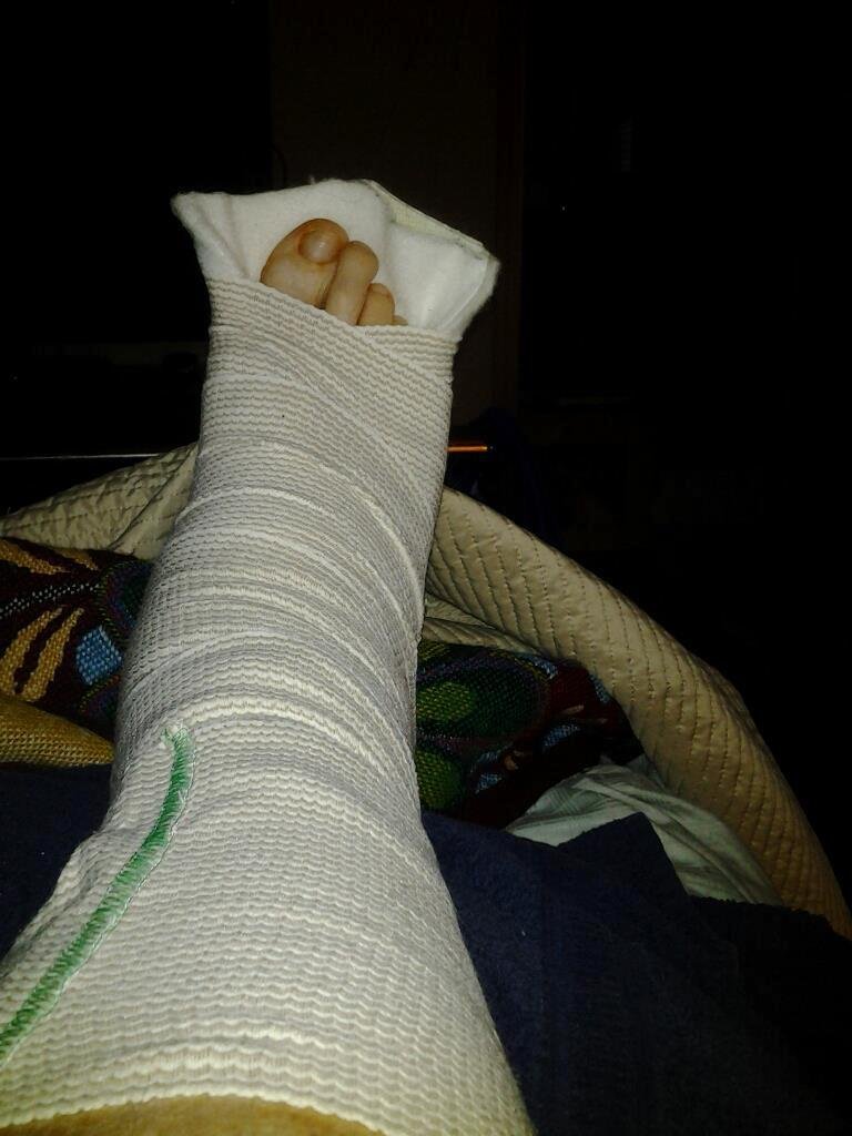 Well, i am tired of laying in bed with my foot elevated. I had foot surgery on the 28th so i am stuck at home with this lovely splint on my foot/leg. No New Years celebrating for me this year. :-(