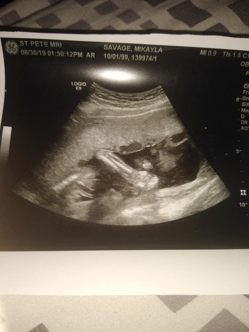 My grandson 💙👣 Kamari David due Jan. 7th 2020.