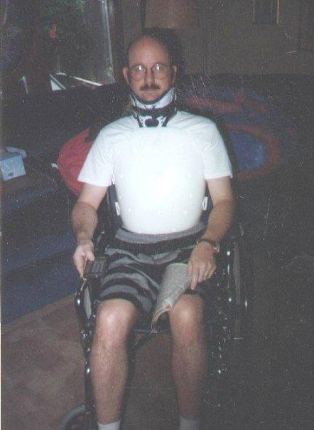 After my accident in 1996 -"Miami J collar' for C4-C6 trauma,Thoracic-Lumber-Sacral Orthosis (body brace). My posture was never beter.