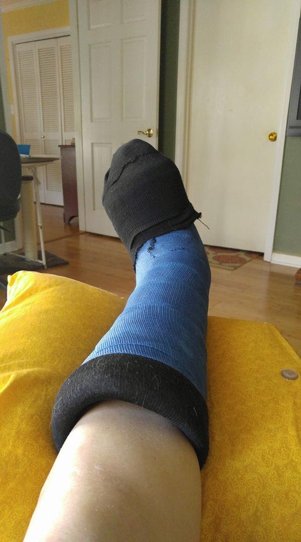 While getting off of the boat , I attempted a triple Lutz double axle combo but just could not stick The Landing. Broke my fibula as well as my great toe. Glad I did not go for the quad, I would have ended up in the lake.