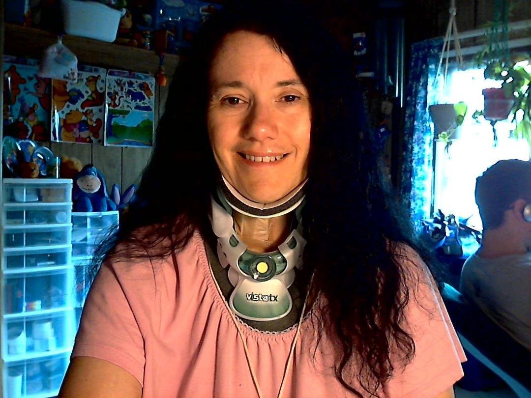 This is 3 days after major neck surgery!