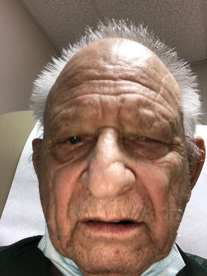 Someone did the macarena on my face? 9/x/2020.
