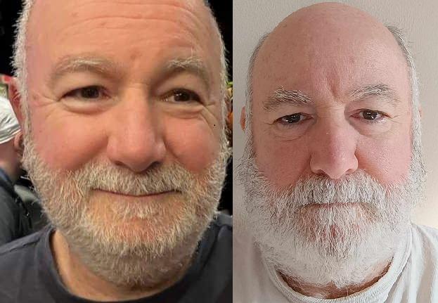 My Santa beard preparation progress for 2023 (left) and 2024 (right).