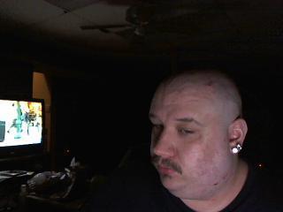 damn razor burn!!!