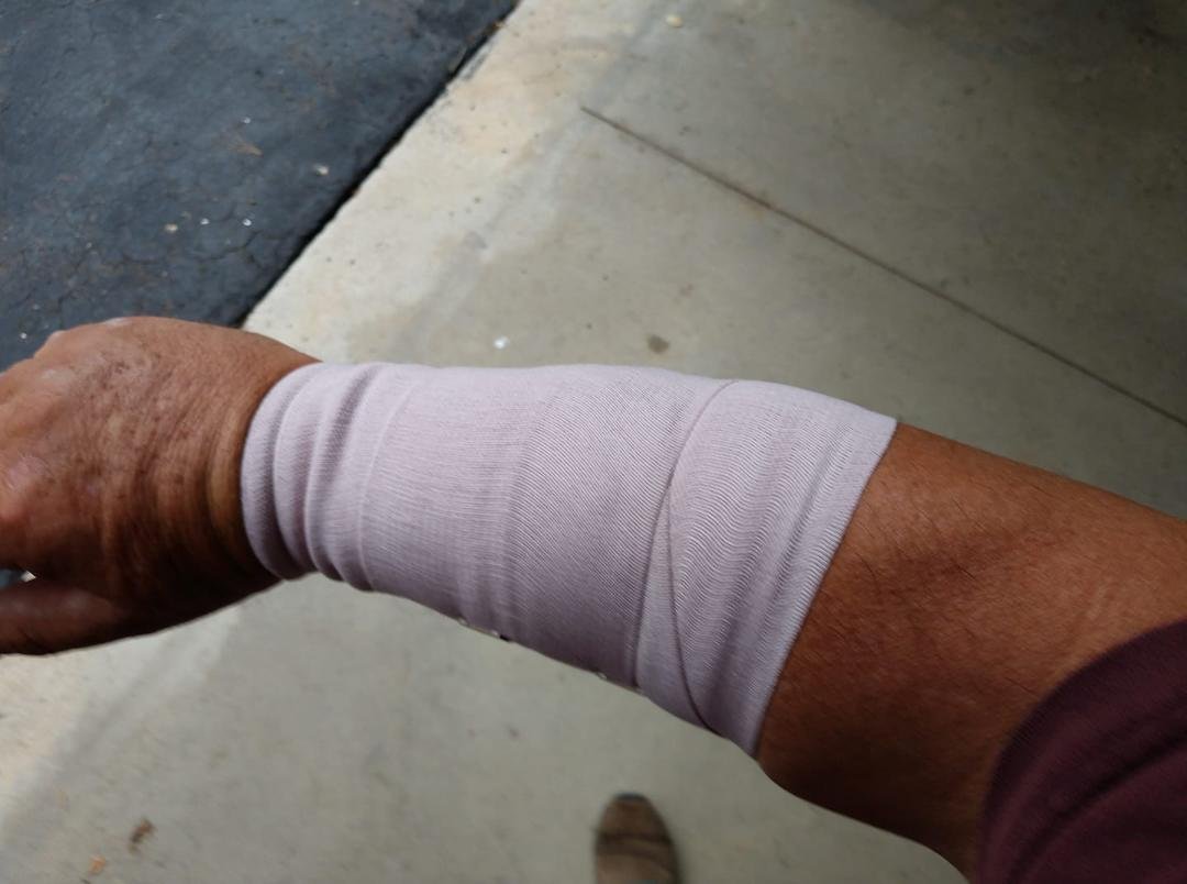 Our first day at the island and an out of control dog belonging to our neighbor attacked me. 1 hour in urgent care, shots, scrubbing and antibiotics for two weeks and hope all heals correctly. " Expect scaring" gotta love