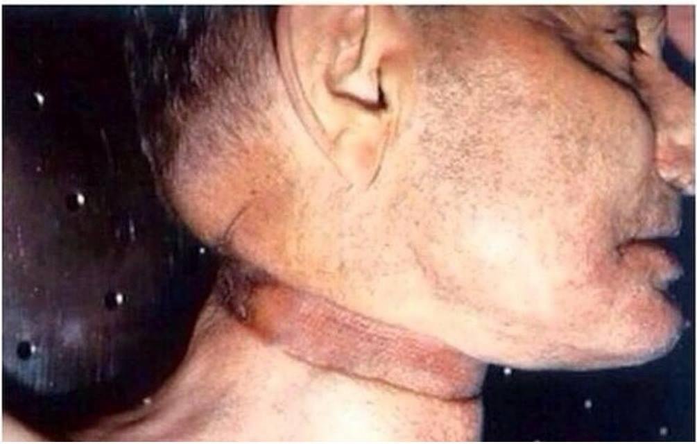 O.K. you morbid fucks. Here it is, Robin Williams death photo.