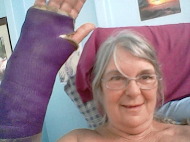 If I to the dr tomorrow to see if I get a new cast or a splint. So tired of this but it WILL be over.
