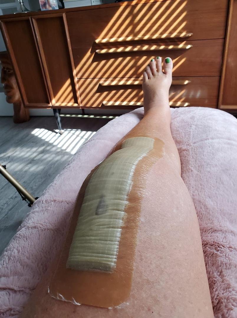 Not too bad for day 4....lots if pain but pushing through it.
