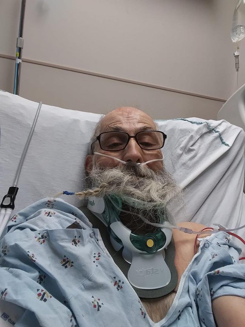I have no idea who's crazy idea it was to braid my beard like this while I was out cold and in surgery