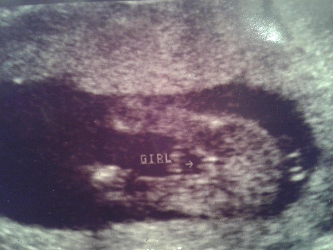 Her butt is sticking out how funny . She is already being a clown