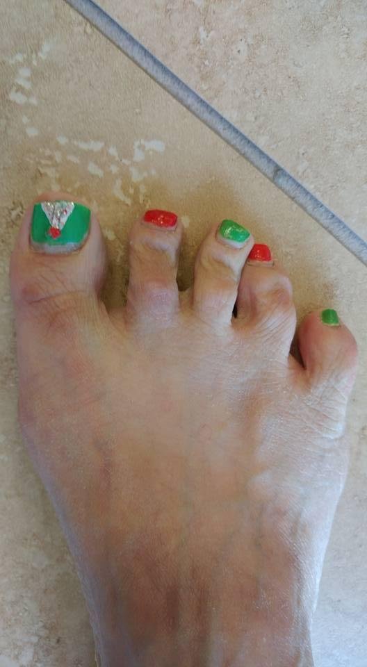 My Rt foot / big toe done Christmas 2016 -- Christmas Tree.