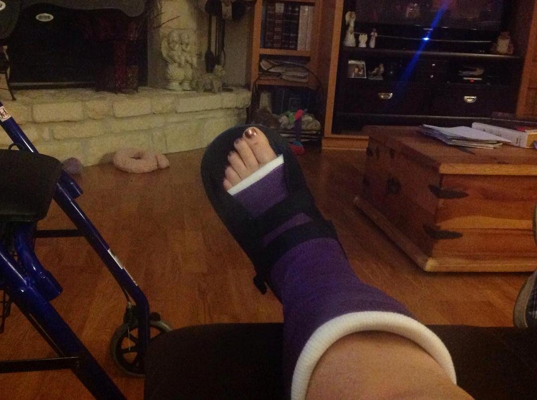 My latest addition in foot ware! Purple cast! Have 3 weeks to sport this new fashion! At least it is my favorite color of purple!!! Foot not healed yet....