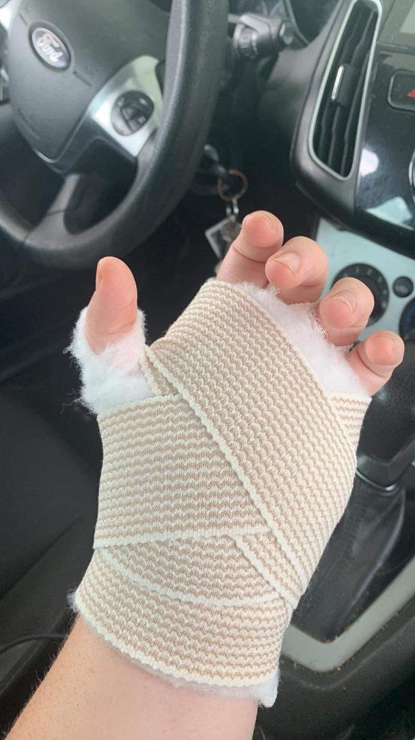 Carpal tunnel surgery is no joke I’m in so much pain right now