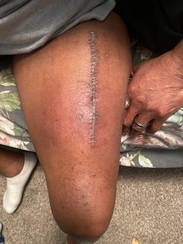 Marcus Davis' album, Timeline photos