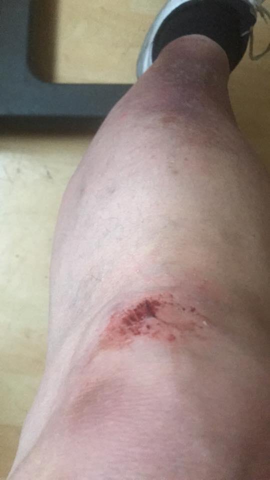 See what happens when you don’t watch your step!