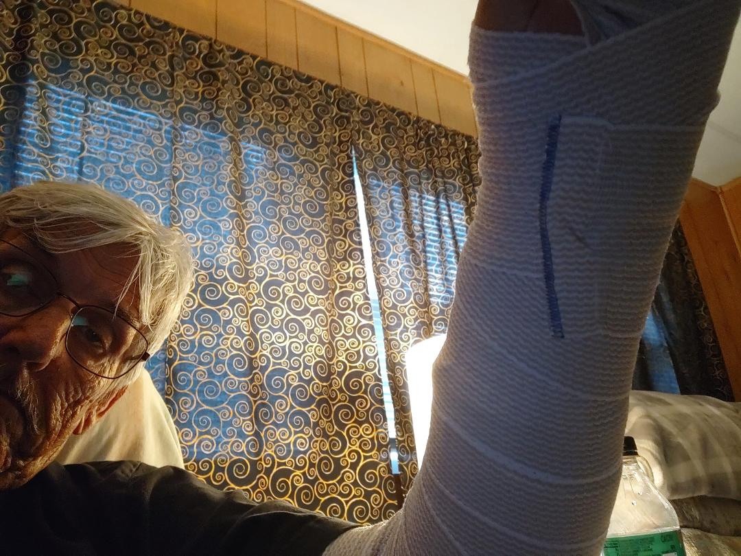 My trip to Arizona has been cancelled, broke my elbow, GF not happy.