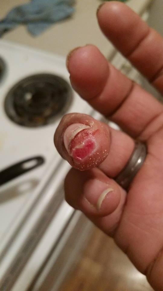 So this is what happens when you lose a fight with a mandolin