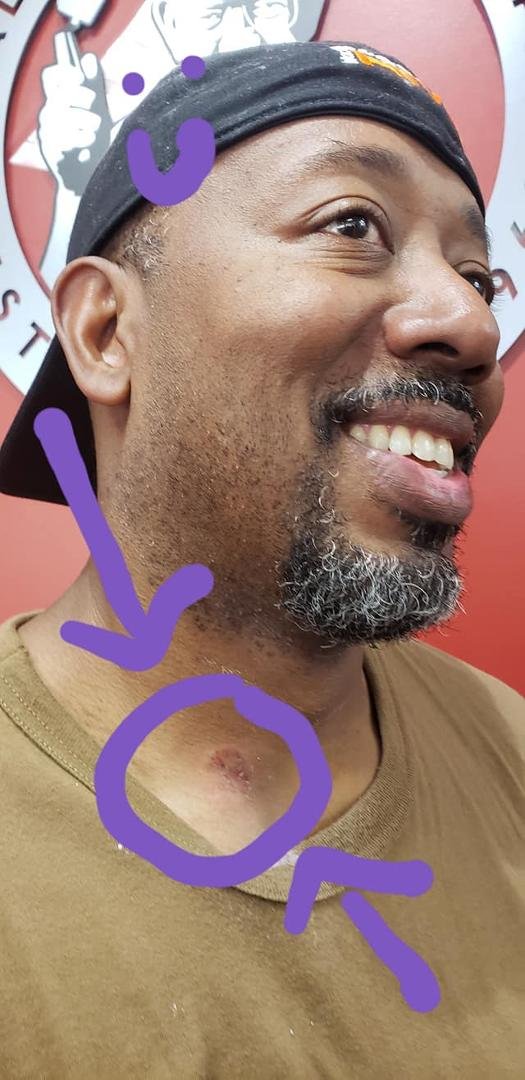 It's wasn't me... but that's gonna look really bad later... bleeding from the neck