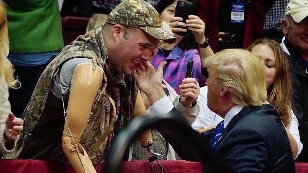 Amputee has no arms so President Trump gently touches his cheek. This is the person some of you want to hate?