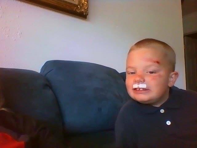 Well, I got yet ANOTHER call from the nurse at my son's school. This time he ran into another student. The other student is ok but little man is all scraped up. Here is a picture of what he looks like.
