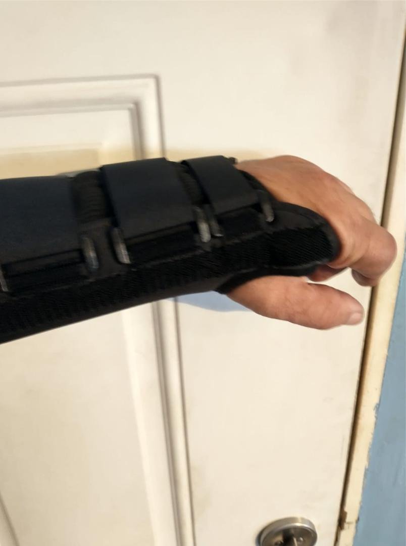 This week didn't start well. Got into a tussle with a trailer crank handle was which kicked back on me striking my wrist. Yep! Sprained wrist. I'm still working though with limited use of my left hand.