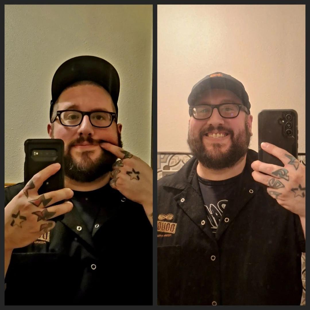 One year apart. 2022 dealing with Bell's Palsy. 2023 recovering from Bell's Palsy.