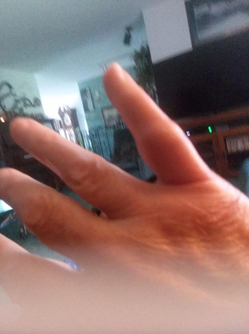 hornet. 3 times. same little creature, as I was putting my recycles in the can. Really itches, so put on anti itch. ice and benadryl.