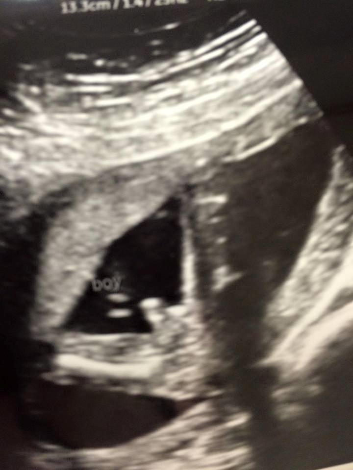 Just found out that our 15th grandchild will be a boy! He is due to arrive about October 18! Grandma & Grandpa are very pleased and excited!
