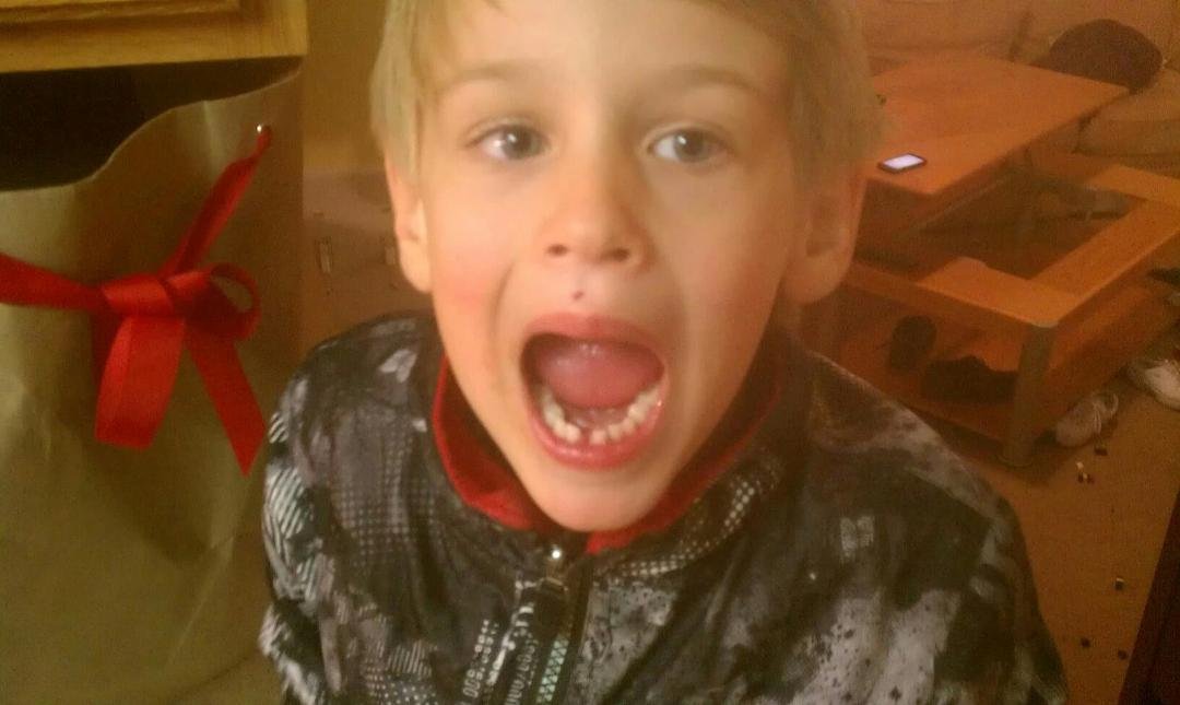First tooth, knocked out by his brother