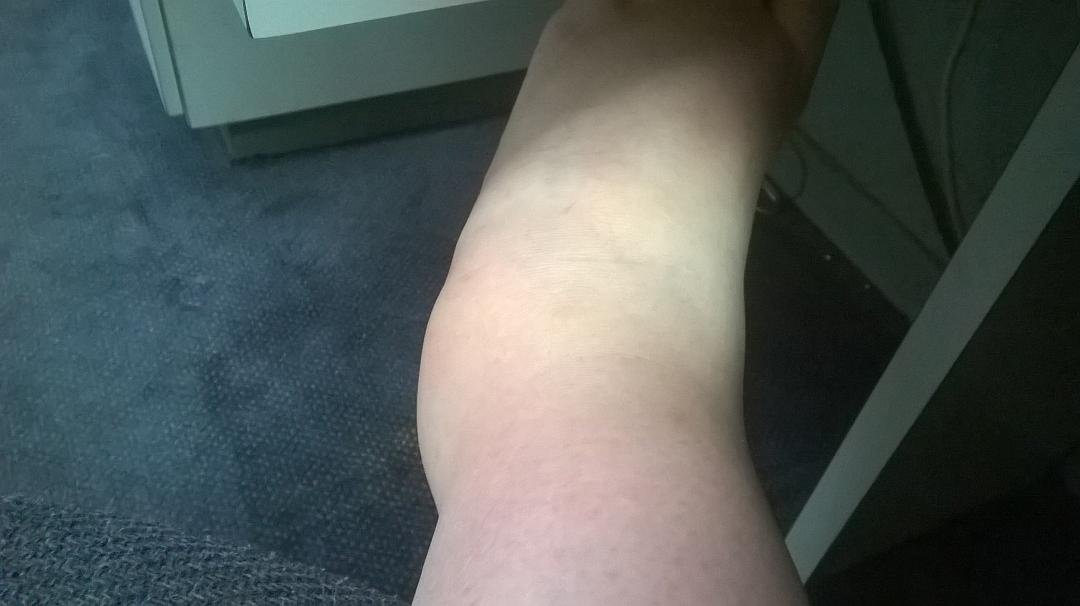 I swear that's my ankle