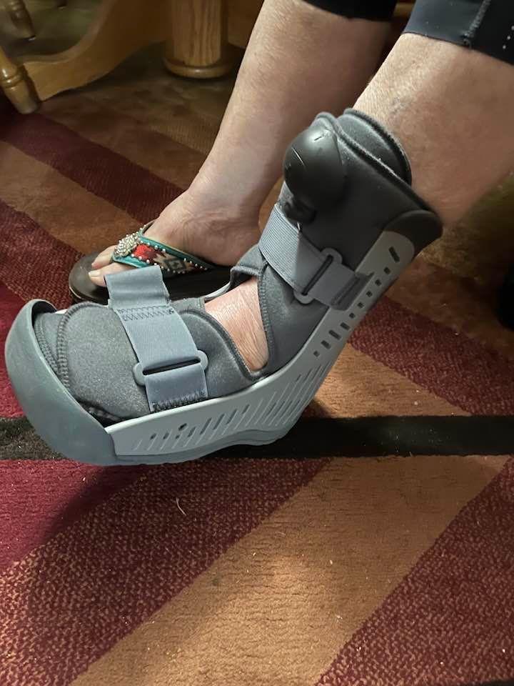 Bev is doing much better.  She can wiggle her toes a little.  She will be booted for about 2 months.