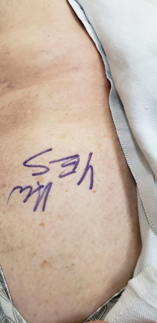 So glad Dr. Wassif signed the correct knee...lol