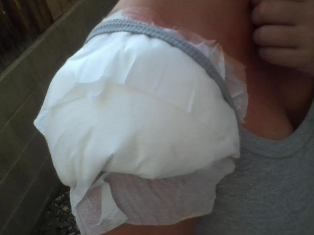 Shoulder surgery...