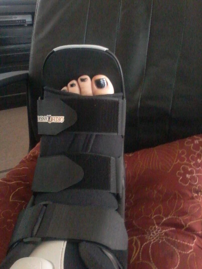 Boot today for 4 wks, can walk without crutches in few days!
Yay!