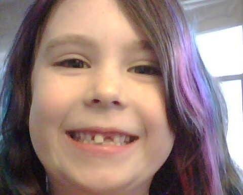 One less tooth