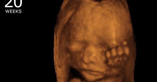 Pray for NY. Murderers! Now allowing abortions up to birth.