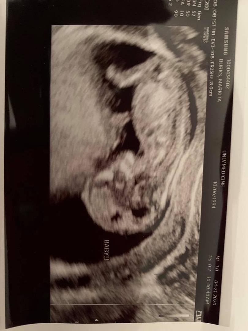 my son chris daniel's future son coming along just great