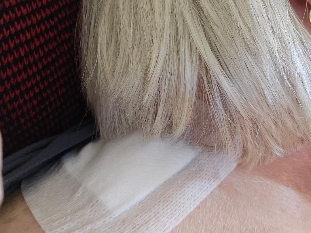Well it's done and I hope it is successful!! I'm so sick of being in pain!!
Rhizotomy save me!!!