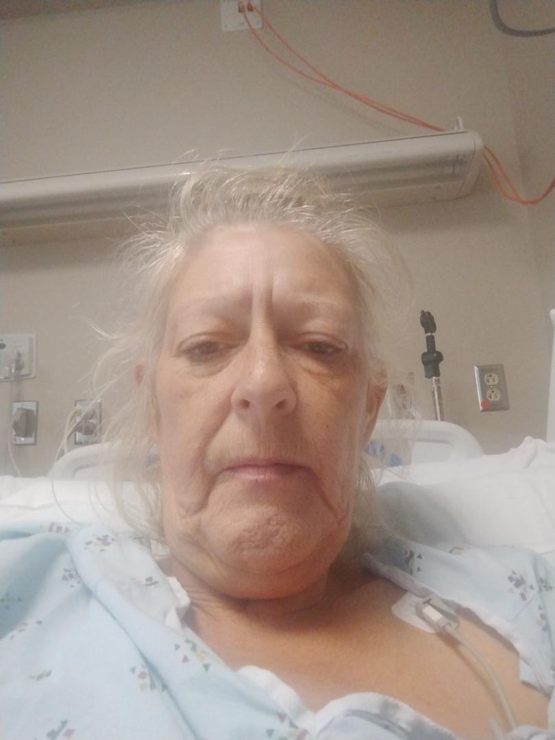 Well everyone is asking what happened I'm going to be the one to tell you I had a double bypass and what we thought was going good ended up being a set back but this past Saturday I got to feeling really sick 🤢 needless to