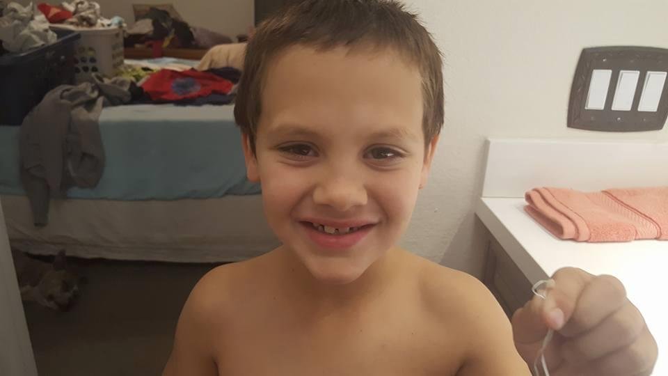 Another baby tooth bites the dust. Trystan "It's a good thing I already brushed my teeth, it's clean and white for the tooth fairy!"