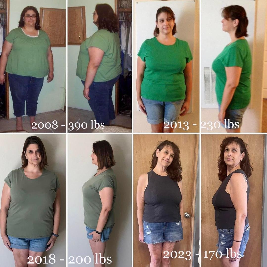 It’s a little early, but I am celebrating the 15th anniversary of my life changing bariatric surgery.
Anyone who says that the surgery is the easy way out are sadly mistaken. It’s just as much hard work as regular dieting