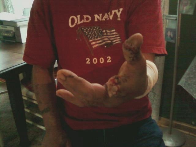 Jack Kinder's album, index finger and thumb