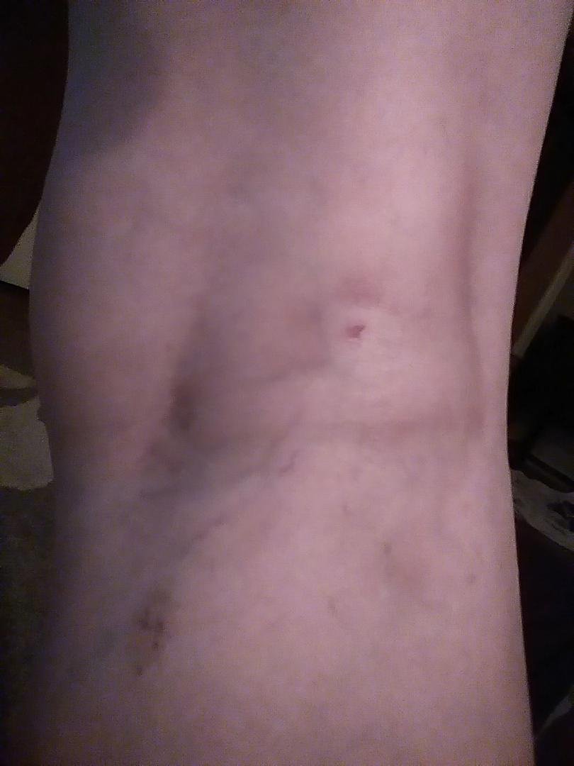 So I was walking Wendel down the street and this dog attacks Wendel and I end up getting bit. Then the dog's owner tells me I shouldn't have intervened in the fight and tells me I am trespassing!!