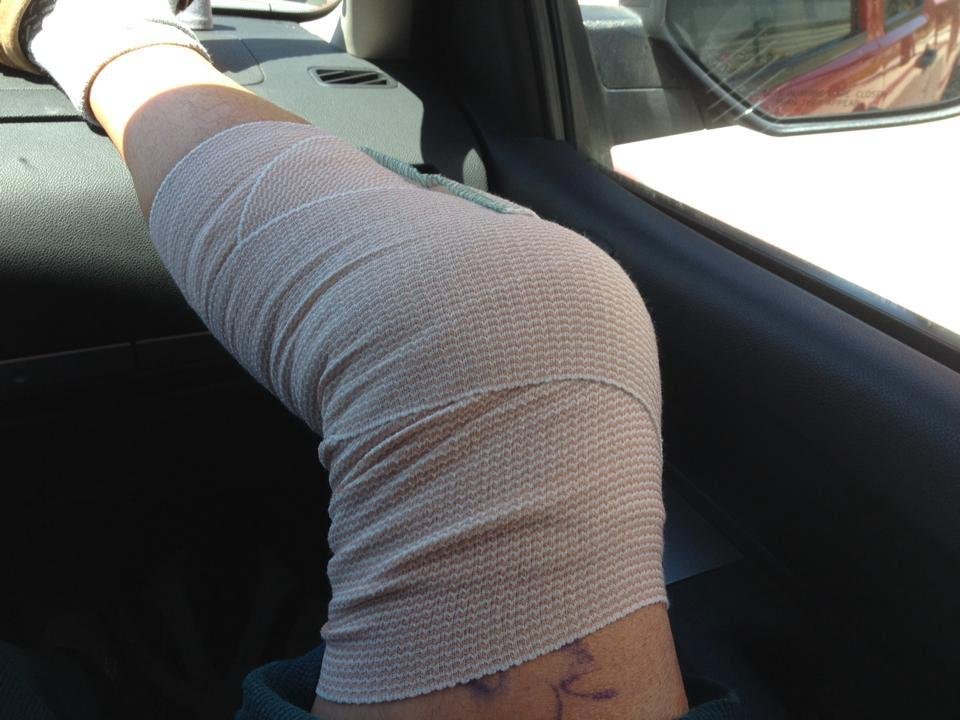 On way home. All went well.