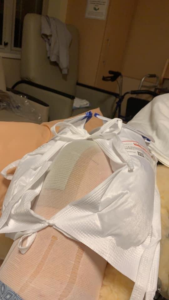 New knee is in and working on the machine